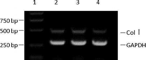 Figure 2. mRNA expression of Col I in mesangial cells (RT-PCR). 1, marker; 2, blank; 3, pSC-GFP; 4, pSC-GFP/Col I.