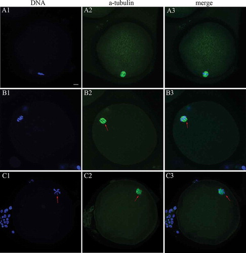 Figure 1. Spindle (green) conﬁguration and chromosomal (blue) alignment in human MII oocytes. (A1-3) Representative normal spindle and chromosomal conﬁguration in human MII oocytes in the 37°C group; (B1-3 and C1-3) representative abnormal spindle and chromosomal conﬁguration in the RT group. Arrows indicate the spindle multipoles and displaced chromosomes. Scale bar = 10 µm. MII: metaphase II; RT: room temperature.