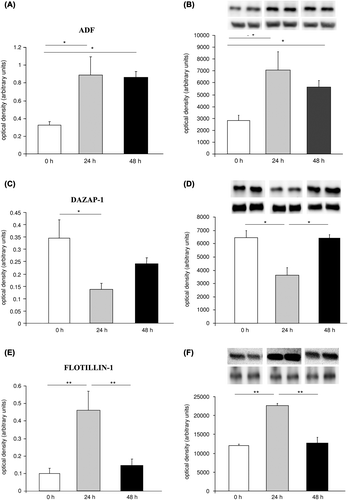 Figure 2. Verification of quantitative results from 2-DE by Western blotting in abdominal ganglia. Protein level changes after serotonin treatment in abdominal ganglia of ADF detected by (A) 2-DE and (B) Western blotting; DAZAP-1 detected by (C) 2-DE and (D) Western blotting; Flotillin-1 detected by (E) 2-DE and (F) Western blotting. Inserts in B, D, and F depict representative images of original Western blots of target proteins and β-tubulin loading control, respectively. All data display optical densities as mean ± SEM. *P < 0.05; **P < 0.01.