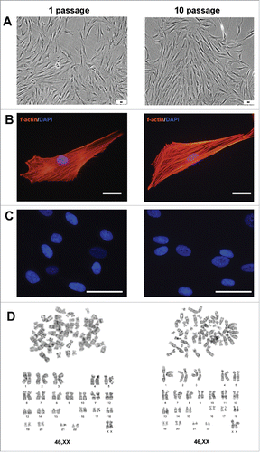 Figure 2. Invariability of AMC morphology and karyotype stability at passages 1 and 10. Typical data of one of ten AMC cultures is presented; similar results have been obtained for other cultures. (A) Phase contrast microscopy of AMC culture at passages 1 and 10 (Bars 50 μm). (B) Immunofluorescence analysis of f-actin bundles (TRITC-phalloidin-red) of AMC at passages 1 and 10, cell nuclei stained with DAPI (Bars 50 μm). (C) Immunofluorescence analysis of morphology of interphase nuclei (stained with DAPI) of AMC at passages 1 and 10 (Bars 50 μm). (D) AMC's karyotyping at passages 1 and 10. G-band analysis of metaphase chromosomes.
