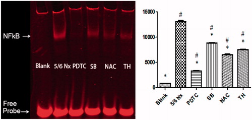 Figure 3. Effects of PDTC, SB, NAC, and TH treatments on uremic rats by EMSA. Normalized densitometric data of NF-κB band obtained from the extracts of proteins with unclear interaction. Data are given as mean ± SD of 4 animals per group. #p < 0.05 compared with Blank group. *p < 0.05 compared with 5/6 Nx group.