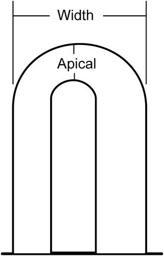 Figure 1. Scheme of the capillary loop measurements (×200). Apical limb width and Capillary width.