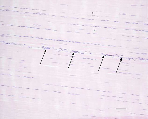 Figure 1.  Microscopic longitudinal section (H&E stained) of a normal tendon (L). Note the aligned fiber bundles with tenocytes in parallel rows and thin endotenon (arrows). L refers to tendon ID (see Tables 1 and 2). Bar = 100 μm.