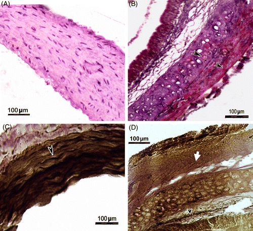 Figure 4.  Transverse sections of the thoracic aorta of a control rat (24 weeks no stress; A), and a rat stressed for 24 weeks (B) stained with Oil Red O for localization of lipids. Note the Oil-Red-O-positive lipid deposition (arrow heads) in the section from a stressed rat (B). Transverse sections of the thoracic aorta of a control rat (24 weeks no stress; C), and a rat stressed for 24 weeks (D) stained with van Gieson technique to demonstrate elastic fibers (arrow head) and collagen (solid arrow). Note the presence of abundant elastic fibers in the control rat aorta (C) and depletion of elastic fibers and abundant collagen deposition in the stressed rat aorta (D).