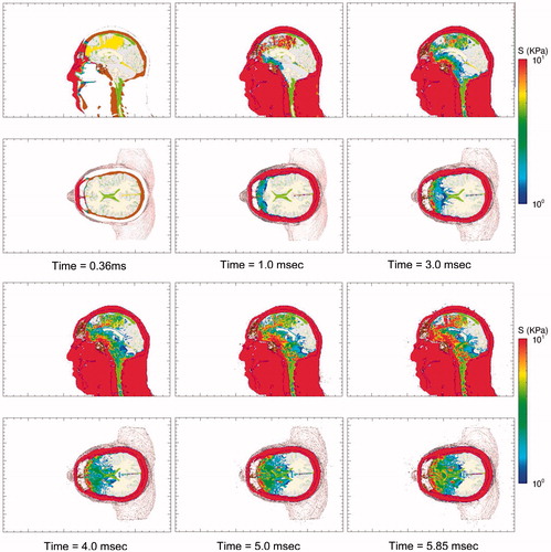 Figure 6. Time-lapse images of frontal blast exposure showing deviatoric shear stress levels in the mid-sagittal and supraorbital axial planes of the head-neck model.