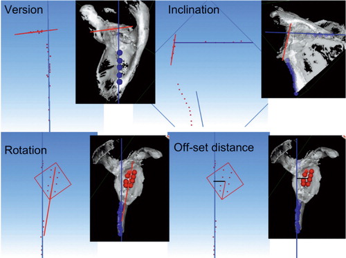 Figure 3. The four position parameters (version, inclination, rotation, and antero-posterior offset distance) are illustrated graphically. Calculated glenoid orientation is shown in red and scapula blade orientation is shown in blue.