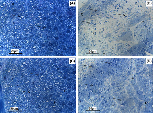 Figure 7. The regenerating numerous axons (arrow) form regular fasicles in 8th (A) and 16th (C) weeks of autograft group. The PHBV graft is surrounded by an inflammatory capsule (c) consisting of phagocytic and fibroblastic cells at its inner side at 8th week (B). In PHBV graft group at 16th week (D) the tubes lumen is filled with fibrovascular connective tissue with small blood vessels (asterisk) and regenerating axon clusters with higher numbers at the 16th week (D) compared to the 8th week (B).