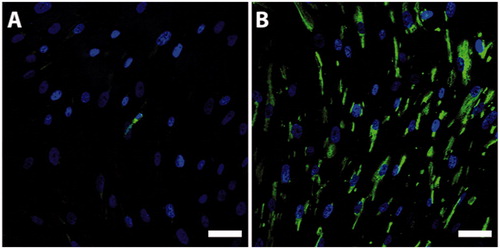 Figure 2. P75-staining of the bone marrow stromal cell culture before (A, green) and after (B, green) CD271 magnetic cell separation. Nuclei were counterstained with Hoechst (blue). The fraction of cells staining positive for P75 after CD271 magnetic cell separation was substantially increased. Scale bar, 50 µm.