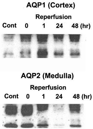 Figure 5. Western analysis of AQP1 and AQP2. Kidneys were subjected to 0 (ischemia), 24, 48, and 72 h of reperfusion following 60 min of ischemia. Cortex and inner medulla of the kidneys were separated and membrane fractions were prepared as described in “Methods and Materials”. Polyclonal anti-rabbit antibodies for AQP1 and AQP2 were used for immunoblot analysis.