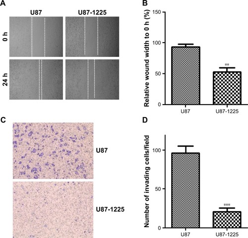 Figure 3 Overexpression of miR-1225-5p suppresses migration and invasion of glioblastoma cells.