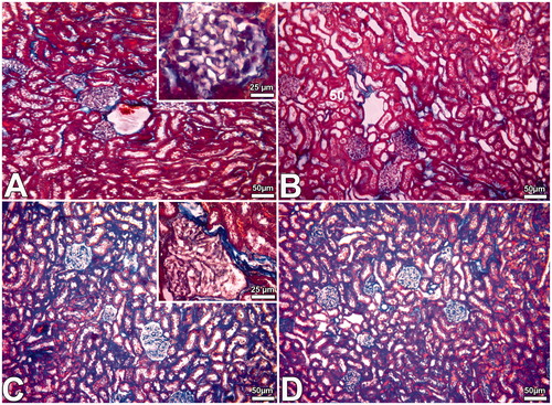 Figure 2. Images obtained from the kidney of the Cont (A), PS (B), DS (C) and DS + MEL (D) groups. Note: More collagen contained interstitial tissue areas were seen in kidney samples of DS group (C and D).