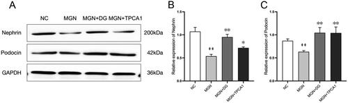 Figure 4. DG restores nephrin and podocin expression levels in MGN rats. (A) Protein levels of nephrin and podocin were evaluated by western blotting. (B, C) Ratio of nephrin and podocin. Data are expressed as the mean ± standard deviation (SD), n = 3. ##p < 0.01 vs. NC group. *p < 0.05 or **p < 0.01 vs. MGN group. NC: normal control; MGN: membranous glomerulonephritis; DG: diosgenin; TPCA1: [(aminocarbony)amino]-5-(4-fluorophenyl)-3-thiophenecarboxamide.