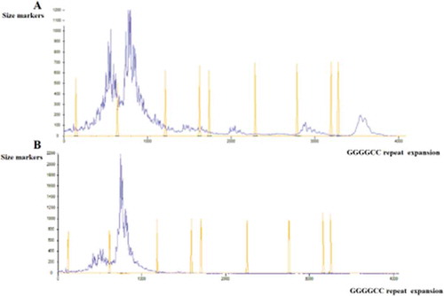 Figure 3. (a) Fragman analysis result showing expanded repeat numbers c.-45+162_-45+163insGGGGCC, (b) Fragman analysis result showing normal repeat numbers in intron 1 of C9orf72 gene.
