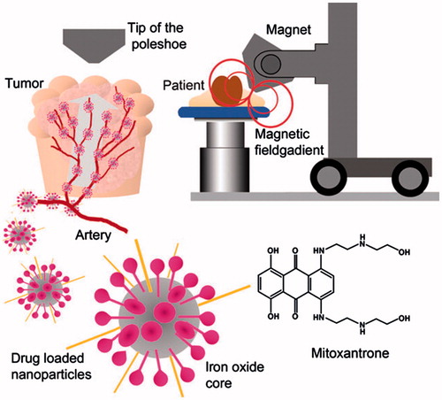 Figure 1. The role of magnetic drug targeting. Nanoparticles-based magnetic iron oxide are functionalized with a chemotherapeutic agent and injected directly into the arterial supply of the tumor (Dürr et al. Citation2013, Namiki et al. Citation2009)