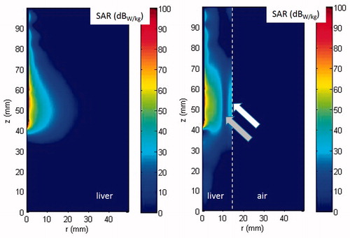 Figure 6. Bi-dimensional distribution in cylindrical coordinates of the SAR computed in unrestricted (A) and double-thin (B) samples. The white dotted line in (B) shows the boundary between liver and air; the arrows highlight the standing wave pattern of the absorbed power, pointing to its local maximum (white arrow) and minimum (grey arrow) values.
