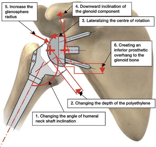 Figure 2. The parameters studied: 1. change in the angle of the humeral neck shaft inclination; 2. change in the depth of the polyethylene cup; 3. lateralization of the center of rotation; 4. downward glenoid inclination; 5. increase in glenosphere radius; 6. creation of an inferior prosthetic overlap with the glenoid bone.