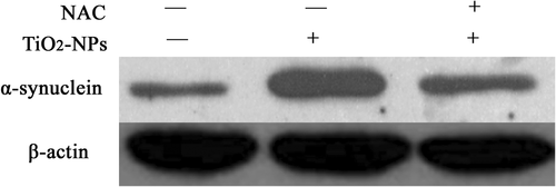 Figure 3. The result of western blotting, showing the α-Syn expression in PC12 cells after treatment with TiO2-NPs and NAC.
