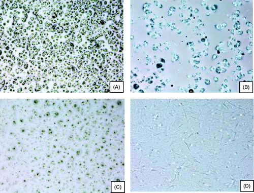 Figure 1. Optical microscope images. (A, B) P3 gel with lower and higher levels of hydration, respectively; (C, D) P4 gel with lower and higher levels of hydration, respectively.