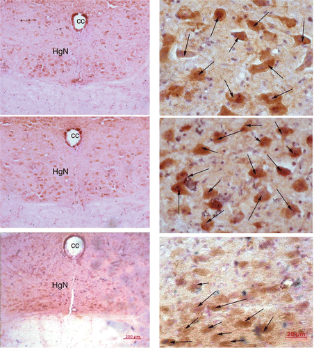Figure 3. These low (left) and high (right) magnification micrographs from medulla sections show the structures and distributions of TRPV3 staining in response to infrared heat treatment in an OR control rat (top), OP control (middle), and OP heated (bottom) rat. Full body infrared heat treatment resulted in a decrease of TRPV3 staining neurons (indicated by arrows) in the hypoglossal nucleus of the medulla (HgN) in an OP heated rat (bottom) compared to an OP control animal (middle).