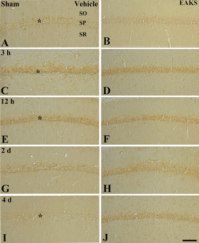 Figure 3.  HNE immunohistochemistry in the CA1 region in the vehicle-ischemia (A, C, E, G, I) and 50 mg/kg EAKS-ischemia (B, D, F, H, J) groups at sham (A, B), 3 h (C, D), 12 h (E, F), 2 days (G, H) and 4 days (I, J) postischemia. In the vehicle-sham group, weak HNE immunoreactivity is detected in the stratum pyramidale (SP, asterisk). In the vehicle-ischemia group, HNE immunoreactivity is increased at 3 h (asterisk) and highest at 12 h (asterisk) postischemia. Four days after ischemia/reperfusion, HNE immunoreactivity in the SP (asterisk) is very low. However, in the EAKS-ischemia group, HNE immunoreactivity is not markedly changed compared to the sham group. SO, stratum oriens; SR, stratum radiatum. Scale bar = 50 µm.