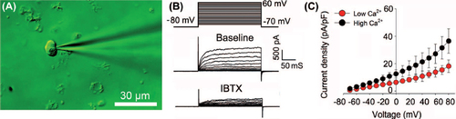 Figure 2. (A) Representative image of whole-cell outward current recording by a patch-clamp technique. Scale bar: 30 μm. (B) Whole-cell BKCa currents recorded from isolated VSMCs before (baseline) and after inhibition with 100 nM IBTX. (C) Current–voltage relationship of BKCa currents with low Ca2+ or high Ca2+. Values are presented as mean ± SD (n = 6 per group).