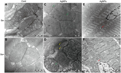Figure 5 Ultrastructural changes of mitochondrial morphology and the mitophagy. (A–D) representative images showing mitochondrial morphology from (A) control, (B) Se-treated, (C) AgNPs-treated and (D) Se+AgNPs cotreated group; Green arrows denote silver nanoparticles within the mitochondria and yellow for outside. (E and F) representative images showing mitophagy in (E) AgNPs-treated and (F) Se+AgNPs cotreated group. Red arrows denote mitophagy.