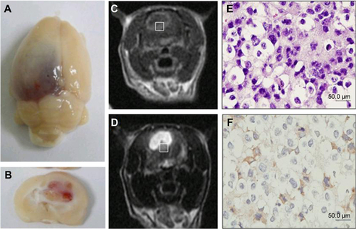 Figure S7 MR Images of ENU-induced rat brain tumor. Gross images of brain tumor specimens (top view [A] and sectioned view [B]); T1- and T2-weighted MR images show an intracranial mass with cystic necrosis (T1-weighted MR image [C] and T2-weighted MR image [D]); H&E staining (E) and CD133 immunostaining (F) at 400× magnification in rat brain tumor.Abbreviations: H&E, hematoxylin and eosin; ENU, N-ethyl-N-nitrosourea; MR, magnetic resonance.