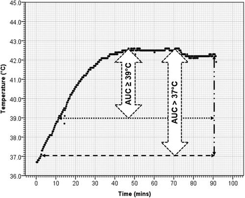 Figure 2. A representative time–temperature plot from a patient of urinary bladder cancer undergoing hyperthermia. Temperature represents the intraluminal temperature in bladder at every 10 s during the entire 90 min of deep hyperthermia. The area under the curve (AUC) for >37 °C (AUC > 37 °C) and ≥39 °C (AUC ≥ 39 °C) represents the corresponding areas enclosed within these temperatures.