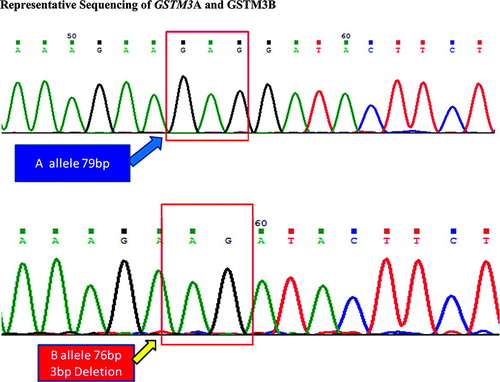 Figure 1.  GSTM3 allele A 79bp and allele B 76bp (3bp deletion in B allele).
