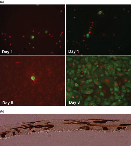 Figure 2. Combined viral and nonviral gene transfer into human keratinocytes performed as previously describedCitation50. a Monolayer cultures of human keratinocytes. The cells were transfected with a retroviral construct containing the LDL receptor gene (left panel) or cotransfected with the same construct and the pPAM3 plasmid containing gag pol and env genes (right panel). The LDL receptor protein was visualized using immunostaining at the indicated time points after transfection. (Green = FITC‐labeled LDL receptor protein; red = propidium iodine‐staining of nuclei) for colours please see (50). After cotransfection the cells produce retroviral vectors that subsequently transduce 100% of the cells. b Raft cultures of human keratinocytes cultured in the liquid‐air interphase. The cells were transfected in monolayer with a retroviral construct containing a GFP gene and the pPAM3 plasmid containing gag pol and env genes and subsequently induced to differentiate to a multilayered tissue. GFP protein was visualized using immunostaining as described Citation50. The anti‐GFP antibody was visualized using peroxidase‐staining leading to the brown color. GFP‐positive cells are found in all layers of the tissue. In control cultures transfected with the GFP construct alone no GFP‐positive cells were found at this time point (13 days after transfection) (data not shown).
