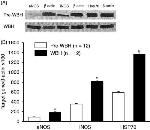 Figure 2. Western blot analysis of the eNOS, iNOS and Hsp70 protein expressions in liver tissues after WBH compared with pre-WBH group. The results indicate significant increases in eNOS, iNOS and Hsp70 expressions (*p < 0.05) in the WBH group. Representative western blot with an immunodetection of eNOS, iNOS and Hsp70 were done using Gene-RL western-blot assay kit (Gene Research, Taiwan). β-actin is an internal standard (n = 12 for each group). The abbreviations are the same as Figure 1.