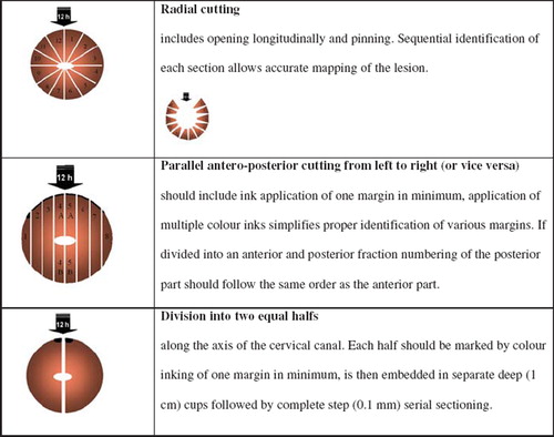 Figure 1. Examples of techniques for sectioning exision biopsies.