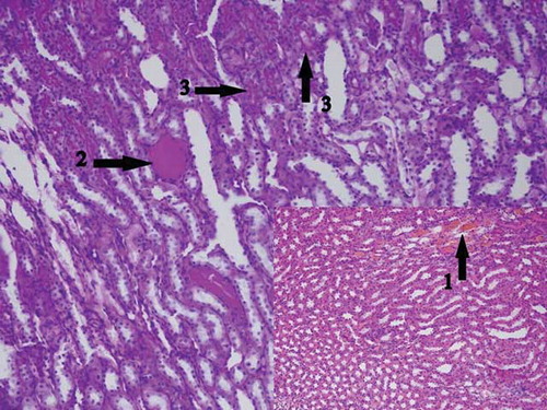 Figure 10. The histopathological examination of the renal tissue of renal ischemia-reperfusion contralateral kidney (RIRCL) group. Mild hemorrhage in interstitial area (Arrow-1) and tubular hyaline cast accumulation (Arrow-2) were observed. Microvilli structures in proximal tubular epithelial cells appeared to be preserved (Arrow-3).