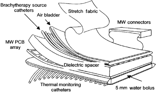 Figure 1. Diagram of the layers in the multilayer conformal applicator, including thermal monitoring catheters, a waterbolus, a printed circuit board microwave array, a dielectric spacer, brachytherapy catheters, and an inflatable air bladder. The stretch fabric is a separate elastic garment that may be worn over the applicator.