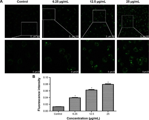 Figure 4 The autophagy induced by TNPs.Notes: (A) Confocal microscopy images of MDC staining showed that the fluorescence intensity was increased in a dose-dependent manner. (B) Quantification of MDC staining by fluorescent intensity analysis. *P<0.05, compared with control. Data are expressed as mean ± SD; n=3 (scale bar: 25 μm).Abbreviations: MDC, monodansylcadaverine; SD, standard deviation; TNPs, titanium dioxide nanoparticles.