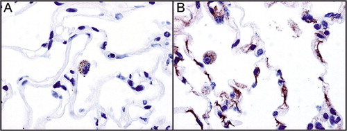 Figure 2. Immunohistochemical staining of paraffin‐embedded adult human distal lung with GPRA‐A (A) and ‐B isoform (B) specific antibodies. Both isoforms are present in alveolar macrophages and B isoform additionally in alveolar epithelium.