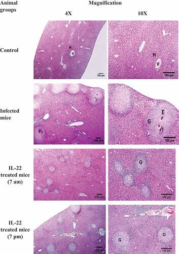 Figure 2. Photomicrographs of sections of liver showing a normal liver structure with hepatic strands (H) surround central veins (v) in the control mice. Sections of S. mansoni-infected mice showing a number of granuloma (G) with eggs (E). Sizes of the granuloma in IL-22 (0.36 µg/kg) treated groups appear smaller than the infected group (H&E, scale bar = 100 μm).