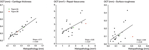 Figure 3. Graphical comparison between OCT and histopathology (x-y plot). The figure depicts measurements of the quantitative parameters cartilage thickness, repair tissue area, and surface roughness, with fitted linear regression lines. Measurements from a good match between OCT and histopathology (Figure 2A) and a fair match (Figure 2B) are shown in green and red, respectively.