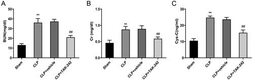 Figure 1. TAK-242 Relieves sepsis-induced kidney injury. (A–C) Detection of BUN (A), Cr (B), and Cys-C (C) levels in serum of rats in the Sham group, CLP group, CLP + vehicle group, and CLP + TAK-242 group. **p < 0.01, vs. Sham group; ##p < 0.01, vs. CLP + vehicle group. BUN: blood urea nitrogen; Cr: creatinine; Cys-C: cystatin-C.