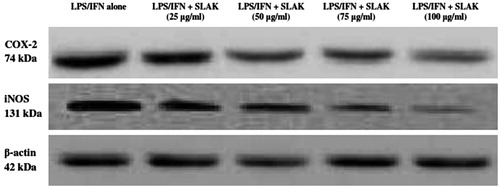 Figures 5. Effect of SLAK on LPS/IFN-induced iNOS and COX-2 expression levels. Lysates were prepared from peritoneal macrophages that were incubated for 24 h with 10 ng LPS/ml + 100 U IFNγ/ml alone or in combination with SLAK (25, 50, 75, and 100 μg/ml). β-actin is shown for housekeeping/gel loading purposes.