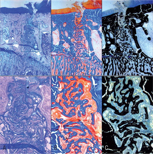 Figure 5. Histological features of the fracture site at postoperative week 2. The new-formed trabeculae were larger than at the previous time point because of the lamellar bone formation. (Upper row 16x and low row 50× magnification. A Giemsa, B Goldner, and C von Kossa stain).