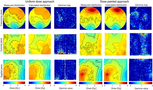 Figure 1. Measurements of the uniform dose approach and the dose painting approach of the seven-field IMRT dose distribution together with the calculated dose distribution and gamma analysis between the measured and calculated distributions, viewed in the transverse plane, the coronal plane and the saggital plane. The dose distributions are shown with 10–90% isodose curves with 10% intervals.
