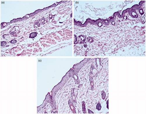 Figure 12. Photomicrographs of skin histology sections treated with (a) Control (b) MOPT-NMP gel treated (c) MOPT-NMP treated.