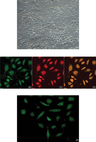 FIGURE 1. Characterization of EPCs. (A) After 7 days in culture, attached cells exhibited a spindle-shaped endothelial cell-like morphology (original magnification × 200). (B, C, D) Adherent cells, lectin-binding (green), DiLDL uptake (red), double positive (orange) were assessed under a laser-scanning confocal microscope (original magnification × 400). The cells were further analyzed by immunofluorescence with (E) VEGFR-2, (F) CD34, and (G) CD133 antibodies (original magnification × 400).