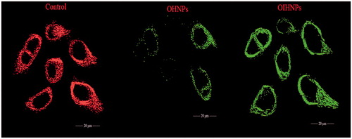 Figure 14. Depletion of mitochondrial membrane potential (ΔΨm) in HT-29 cells induced by OHNPs and OIHNPs. Cells were treated and stained with a mitochondria-selective dye JC-1 and analyzed. Controlled cells produce red fluorescence and green fluorescence (due to the depletion of mitochondrial membrane). Initial row (vertical) represents control that represents intact mitochondria membrane, second row represents partial depletion identified by JC-1 stain where as third row represents complete depletion as can be observed with full change in potential.