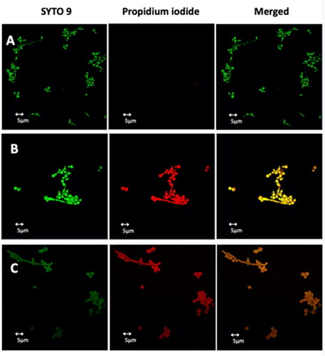 Figure 10. Detection of cell membrane permeabilisation in living C. albicans cells from control culture (A) and cultures treated with Pent-1B (B) or Dec-1B (C) by CLSM. The cells were stained with SYTO9 and Propidium iodide (PI). Fluorescence images of the same samples at 528 nm for SYTO9 (green fluorescence; left panels), 645 nm for PI (red fluorescence; middle panels) and merged images (right panels) are shown. SYTO 9 penetrates both viable and nonviable cells, while PI penetrates only cells with compromised membranes. Candida cells showing yellow-red fluorescence are considered as dead cells.