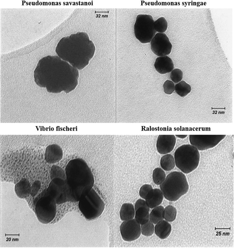 Figure 3. TEM images of individual gold nanoparticles in the presence of four different bacteria.