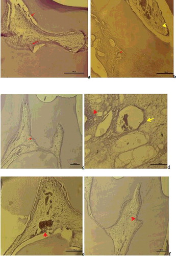 Figure 4. a – Group I: Vimentin expression was observed in degenerative odntoblast cells, fibroblast cells and impaired fibrous structures in the pulp (Vimentin immune staining 50 µm); b – Group II: Vimentin was positive in the degenerative change in the fibres of the periodontal membrane and weak Vimentin expression was observed in scattered fibre distribution in the pulp (Vimentin immune staining100 µm); c – Group III: Vimentin positive expression was observed in odontoblast cells and fibroblast cells and a positive Vimentin reaction was observed in the regular fibre organisation in the pulp (Vimentin immune staining50 µm); d – Group V: Degenerative change was observed in the odontoblast cells of the pulp and positive Vimentin reaction in the impaired fibrous structure around the dilated vessel and in areas of hyalinisation (Vimentin immune staining50 µm); e – Group VI: A positive Vimentin reaction was observed in odontoblasts and in the fibrous structure around the vessel (Vimentin immune staining50 µm); f – Group VII: A positive Vimentin reaction was observed in a diffuse form within the pulp fibroblasts with regular odontoblastic alignment between the dentin and pulp (Vimentin immune staining 50 µm).