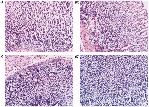 Figure 9. Histological examination for mucosal damage of rats following oral administration of (A) normal saline; (B) IMC; (C) IMC-loaded CMSN; (D) IMC-loaded amino-CMSN.