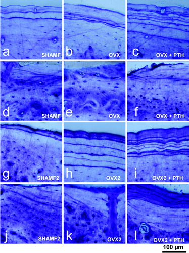 Figure 4.  Tibia cortical bone from female rats. Periosteal and endosteal surfaces as view in 100 μm thick ground sections stained with toluidine blue from prevention (a–f) and intervention experiments (g–l). Note that in prevention study PTH-treatment has a dual effect as new bone formation at periosteal envelope (c) and resorption at endosteal surface (f). On the contrary, in intervention experiment, PTH-treatment produces new bone both in periosteal (i) and endosteal (l) surfaces.
